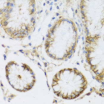 ATP1A Rabbit Polyclonal Antibody - Image 4