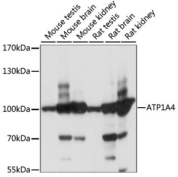 ATP1A4 Rabbit Polyclonal Antibody
