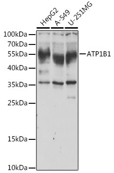 ATP1B1 Rabbit Polyclonal Antibody