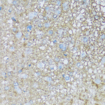 ATP1B2 Rabbit Polyclonal Antibody