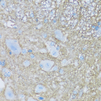 ATP1B2 Rabbit Polyclonal Antibody - Image 2