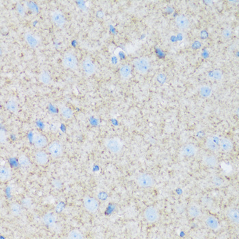 ATP1B2 Rabbit Polyclonal Antibody - Image 3