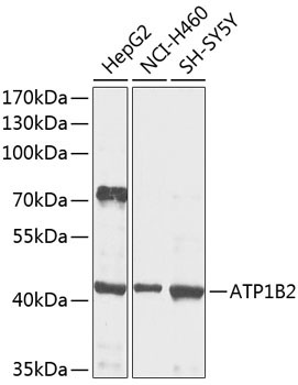 ATP1B2 Rabbit Polyclonal Antibody