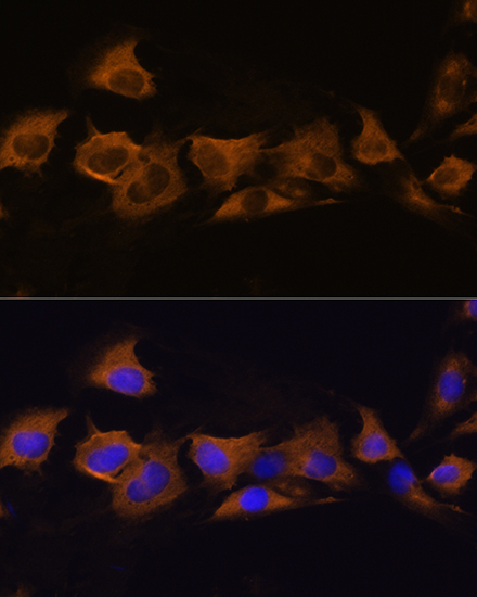 ATP1B2 Rabbit Polyclonal Antibody - Image 2