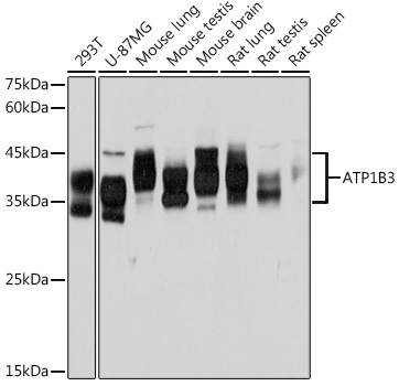 ATP1B3 Rabbit Monoclonal Antibody
