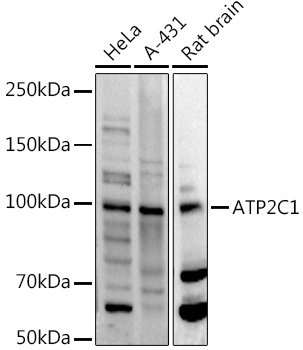 ATP2C1 Rabbit Polyclonal Antibody