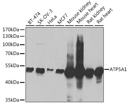ATP5A1 Rabbit Polyclonal Antibody