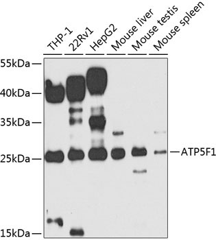 ATP5F1 Rabbit Polyclonal Antibody