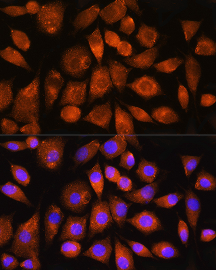 ATP5G2 Rabbit Polyclonal Antibody - Image 2