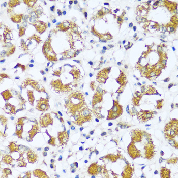 ATP5I Rabbit Polyclonal Antibody - Image 2