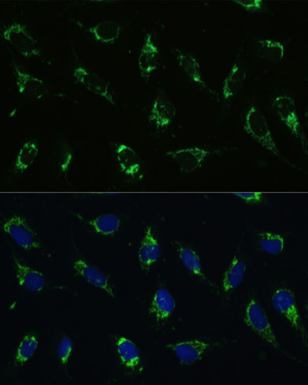 ATP5I Rabbit Polyclonal Antibody - Image 3