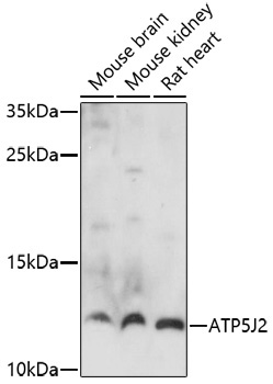ATP5J2 Rabbit Polyclonal Antibody