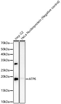 ATP6 Rabbit Monoclonal Antibody
