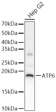 ATP6 Rabbit Polyclonal Antibody