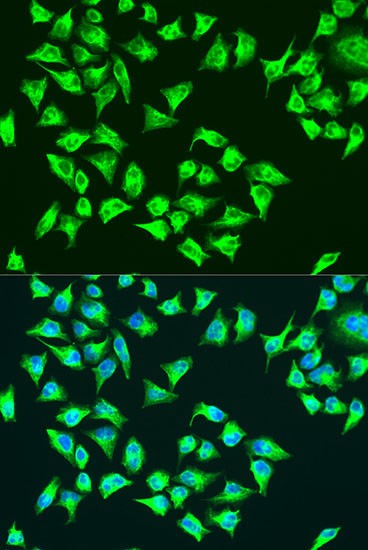 ATP6 Rabbit Polyclonal Antibody - Image 2