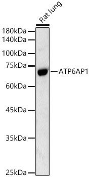 ATP6AP1 Rabbit Polyclonal Antibody