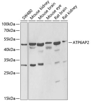 ATP6AP2 Rabbit Polyclonal Antibody