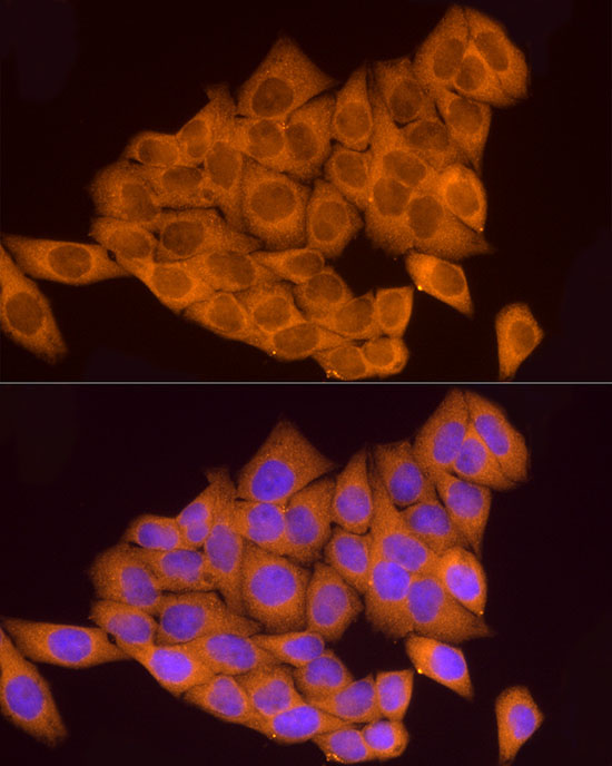 ATP6V0A1 Rabbit Polyclonal Antibody