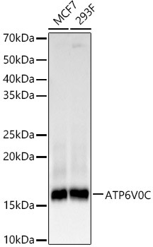 ATP6V0C Rabbit Monoclonal Antibody