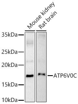 ATP6V0C Rabbit Polyclonal Antibody
