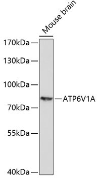 ATP6V1A Rabbit Polyclonal Antibody