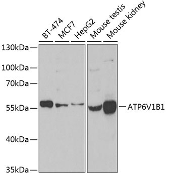ATP6V1B1 Rabbit Polyclonal Antibody