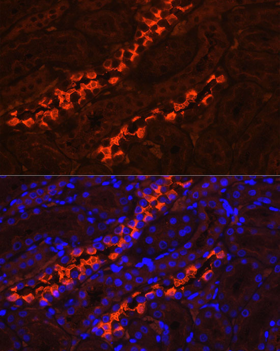 ATP6V1B1 Rabbit Polyclonal Antibody - Image 2