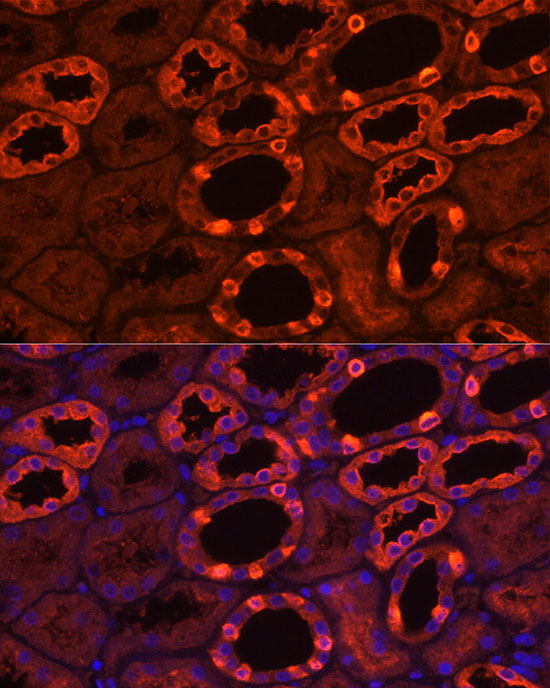 ATP6V1B1 Rabbit Polyclonal Antibody - Image 3