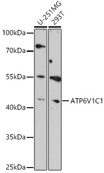 ATP6V1C1 Rabbit Polyclonal Antibody