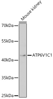 ATP6V1C1 Rabbit Polyclonal Antibody - Image 2