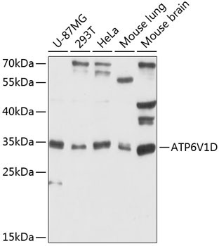 ATP6V1D Rabbit Polyclonal Antibody