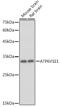ATP6V1E1 Rabbit Polyclonal Antibody