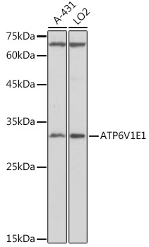 ATP6V1E1 Rabbit Polyclonal Antibody - Image 2
