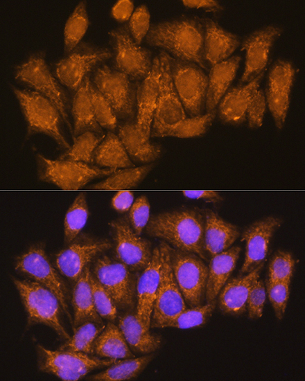 ATP6V1E1 Rabbit Polyclonal Antibody - Image 3
