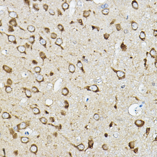 ATP6V1G2 Rabbit Polyclonal Antibody - Image 2