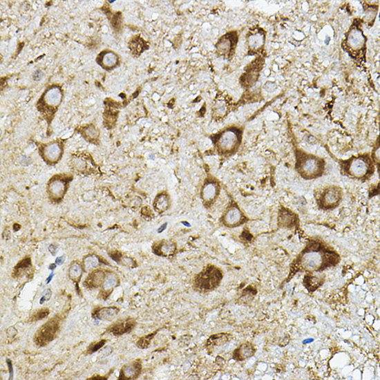 ATP6V1G2 Rabbit Polyclonal Antibody - Image 3
