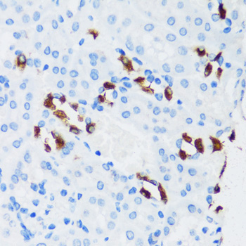 ATP6V1G3 Rabbit Polyclonal Antibody - Image 2