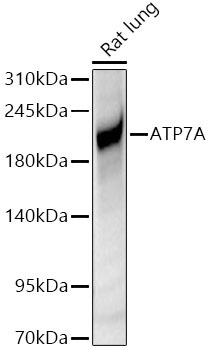 ATP7A Rabbit Polyclonal Antibody