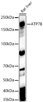 ATP7B Rabbit Polyclonal Antibody
