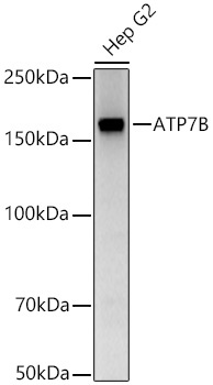 ATP7B Rabbit Polyclonal Antibody - Image 2