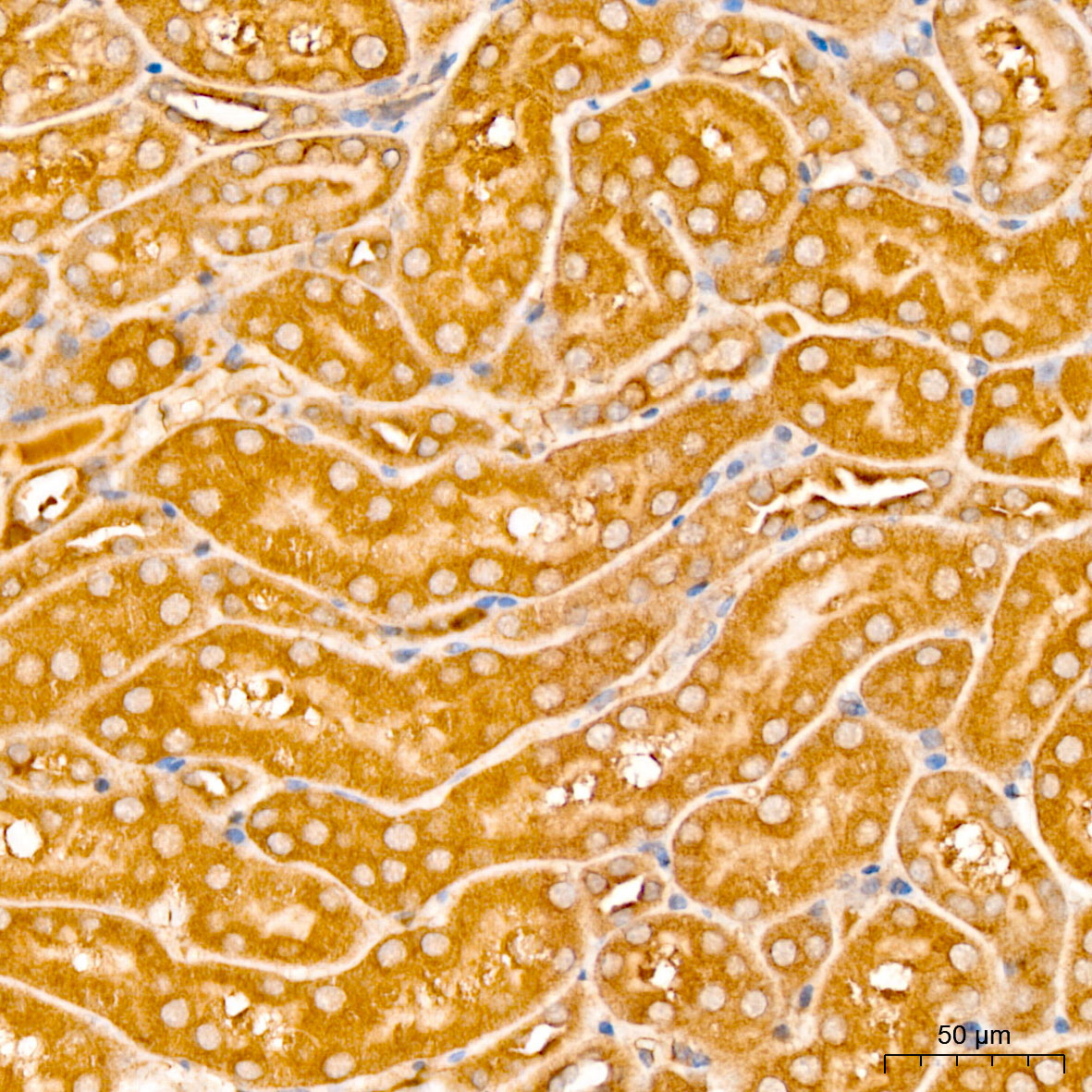 ATP7B Rabbit Polyclonal Antibody - Image 3