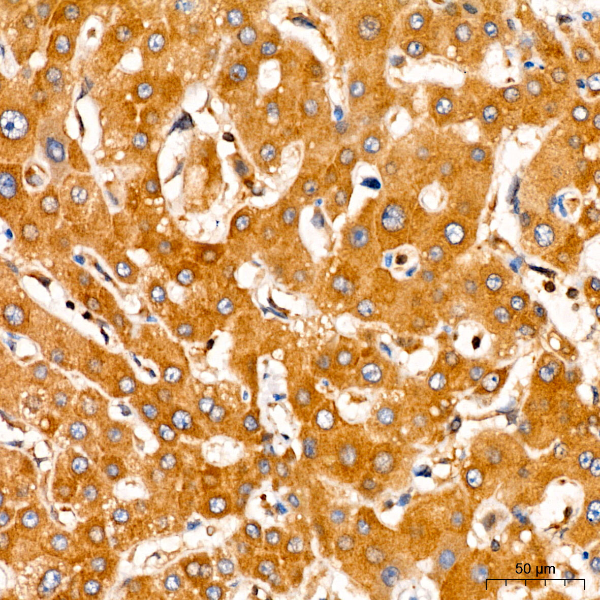 ATP7B Rabbit Polyclonal Antibody - Image 4