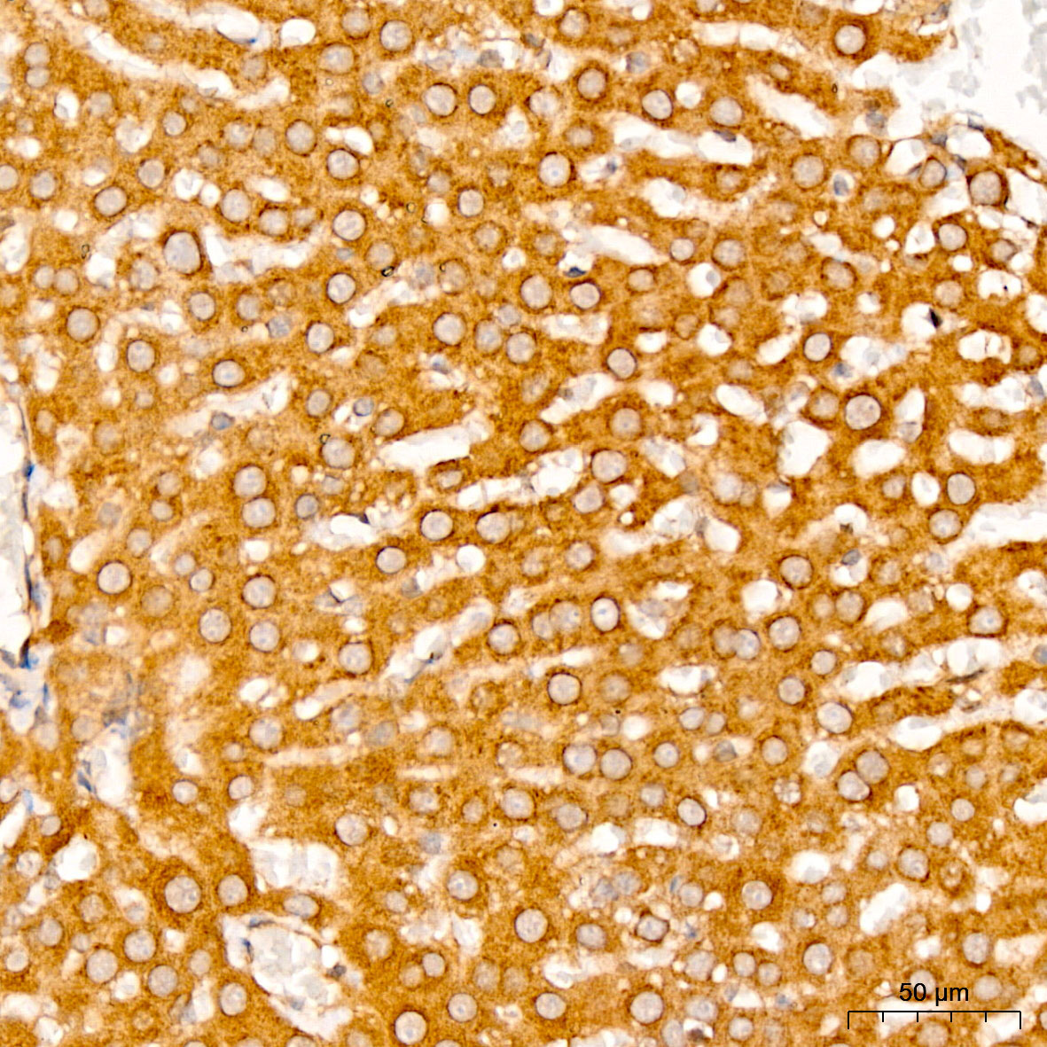 ATP7B Rabbit Polyclonal Antibody - Image 5