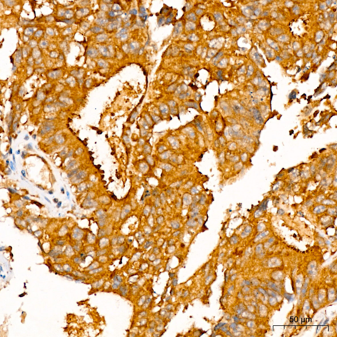 ATP7B Rabbit Polyclonal Antibody - Image 6