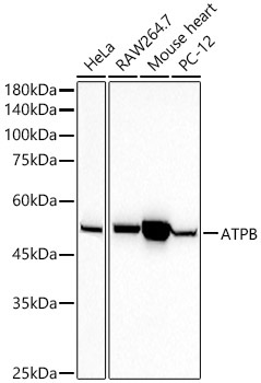 ATPB Rabbit Monoclonal Antibody