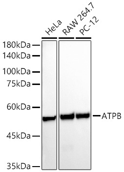 ATPB Rabbit Polyclonal Antibody