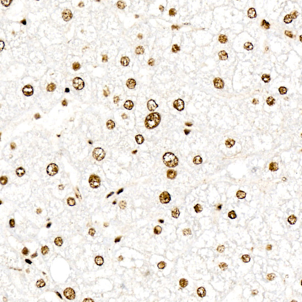 ATR Rabbit Polyclonal Antibody - Image 2