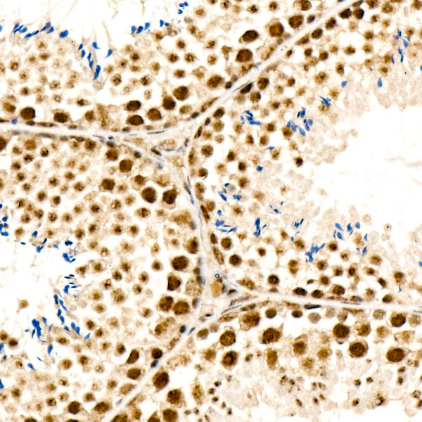 ATR Rabbit Polyclonal Antibody - Image 3