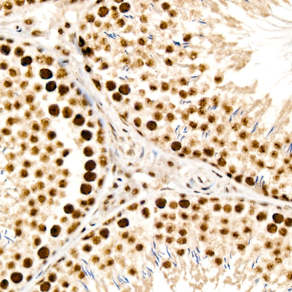 ATR Rabbit Polyclonal Antibody - Image 4