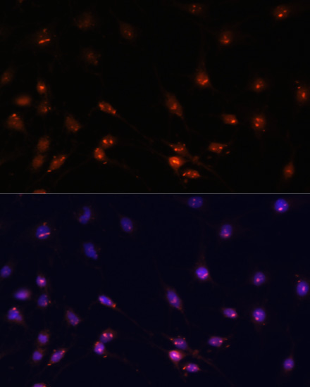 ATR Rabbit Polyclonal Antibody